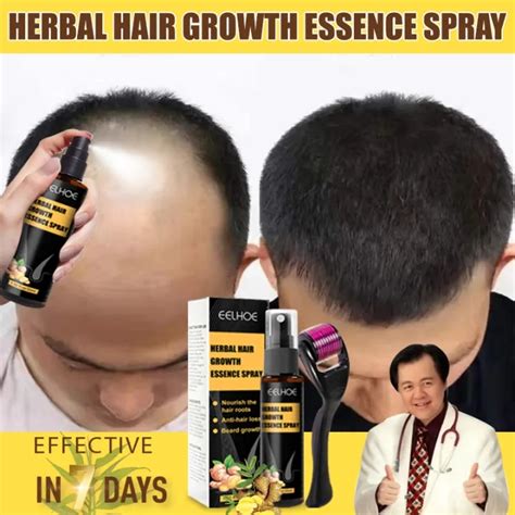 HairTech Hair Grower The Holy Grail for Regaining Your